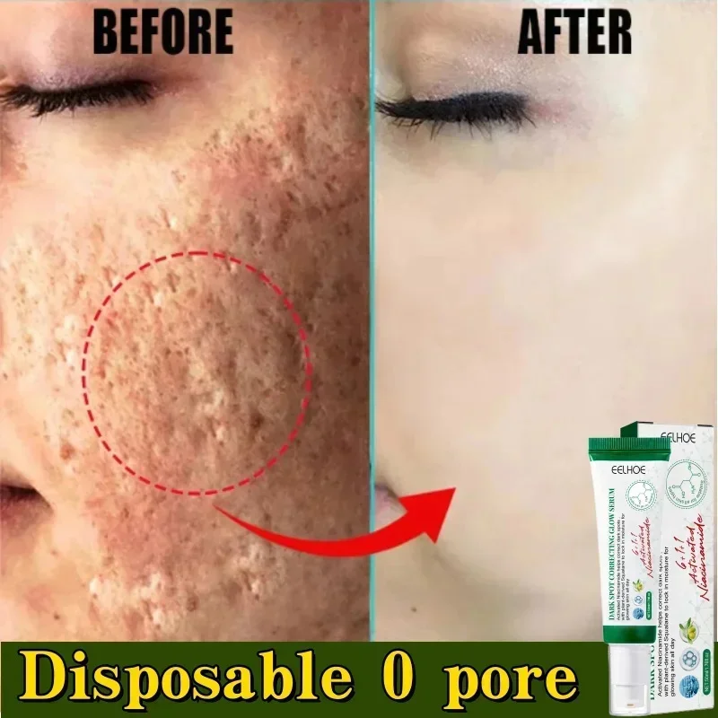 Pore Shrinking Cream Acne Pit Repair Product for Men Women Remove Acne Print Scar Large Pore Anti-inflammatory Smooth Skin Cream
Pore Shrinking Cream Acne Pit Repair Product for Men Women Remove Acne Print Scar Large Pore Anti-inflammatory Smooth Skin Cream