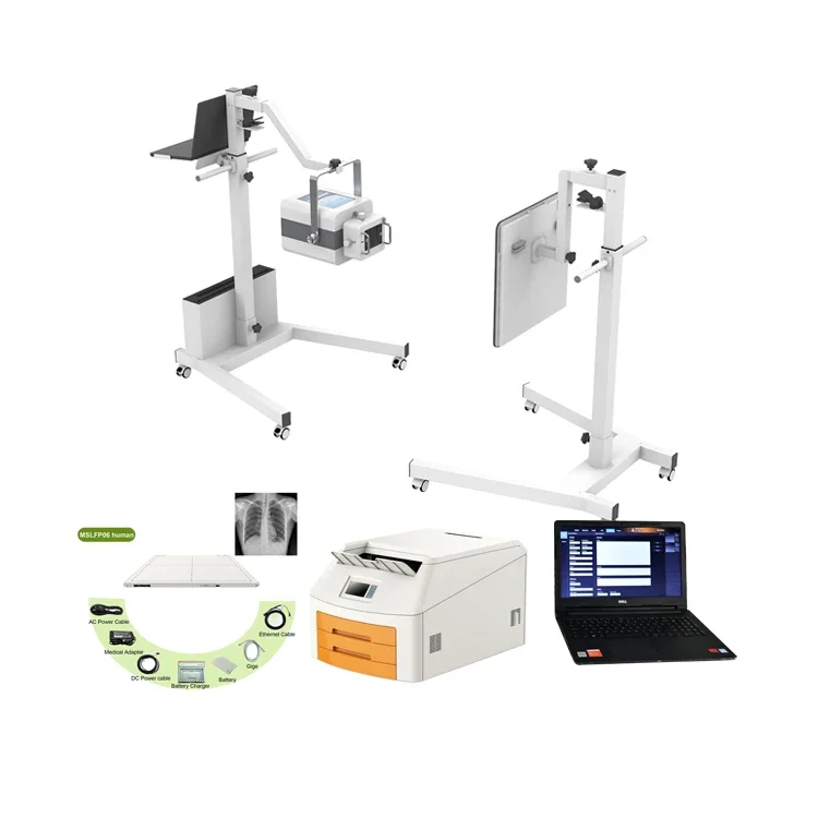 Iray Best Price Digital Radiography X-ray System, 100mA 5KW Mobile High Frequency DR Xray Machine
Iray Best Price Digital Radiography X-ray System, 100mA 5KW Mobile High Frequency DR Xray Machine