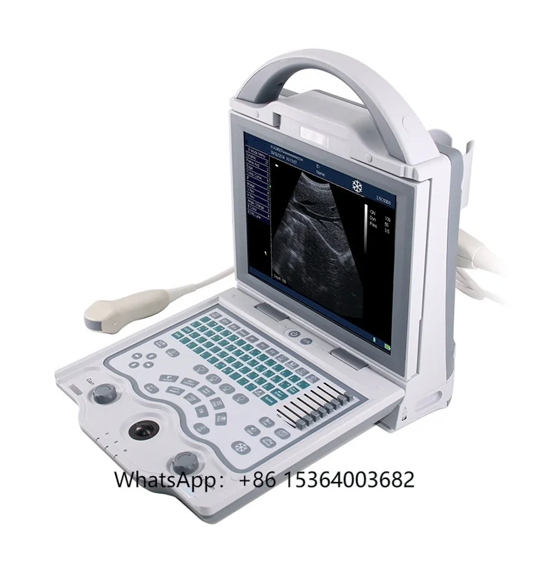 4d 3d 2d Portable Ultrasound for Medical Diagnostic Imaging Veterinary Ultrasound Scanner for Vet Hospital Clinic Machine
4d 3d 2d Portable Ultrasound for Medical Diagnostic Imaging Veterinary Ultrasound Scanner for Vet Hospital Clinic Machine