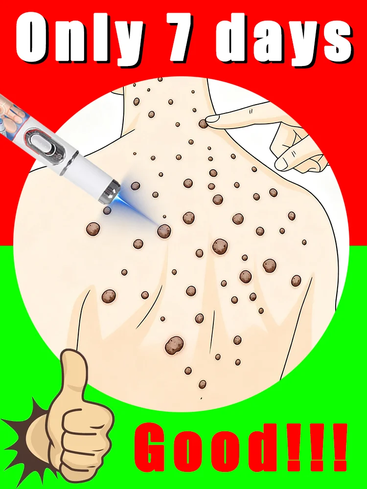 Ручка синего света решает бородавки, красота, горячая распродажа, инструменты для ухода за бородавками, безболезненная, бесплатная доставка
Ручка синего света решает бородавки, красота, горячая распродажа, инструменты для ухода за бородавками, безболезненная, бесплатная доставка