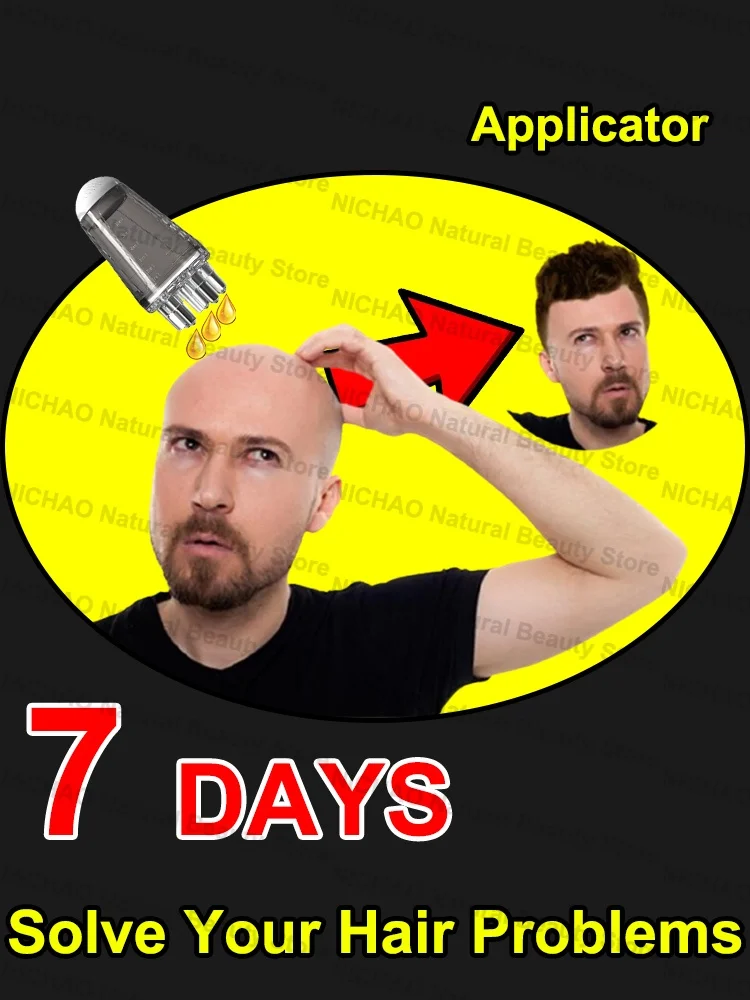 7 Days Fast Hair Growth Essential Loss Regrowth Treatment Strengthens Hair Nourishes Scalp Light Weight Non Greasy
7 Days Fast Hair Growth Essential Loss Regrowth Treatment Strengthens Hair Nourishes Scalp Light Weight Non Greasy