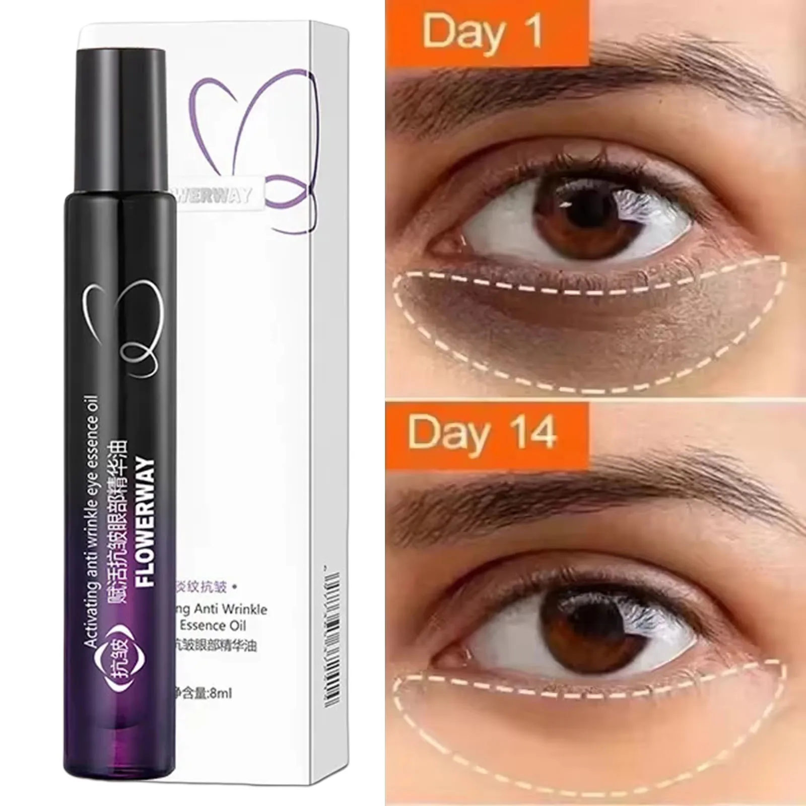 Retinol Eye Serum Fades Fine Lines Remove Dark Circles Eye Bags Puffiness Anti-Aging Moisturizing Brighten Man Woman Eye Care
Retinol Eye Serum Fades Fine Lines Remove Dark Circles Eye Bags Puffiness Anti-Aging Moisturizing Brighten Man Woman Eye Care