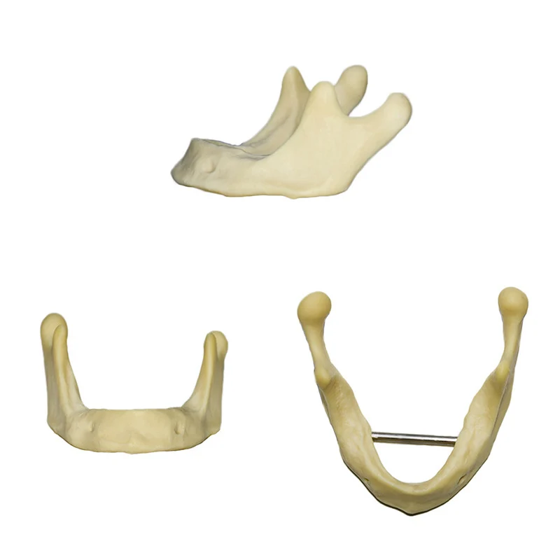 Dental Implant Teeth Model Practice Mandibular Teeth Jaw Teaching Studying Model Demonstration Tools
Dental Implant Teeth Model Practice Mandibular Teeth Jaw Teaching Studying Model Demonstration Tools