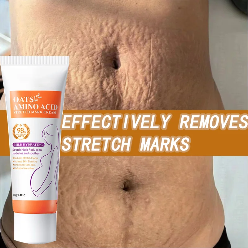 Stretch Mark Cream Pregnancy mark Remover Repair Moisturizer Brighten Postpartum Smooth Belly Thigh Obesity Firm Women Skin Care
Stretch Mark Cream Pregnancy mark Remover Repair Moisturizer Brighten Postpartum Smooth Belly Thigh Obesity Firm Women Skin Care