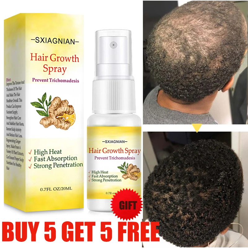 Ginger Fast Hair Growth Serum Spray Regrowth Oil Products Anti Hair Loss Products Prevent Baldness Scalp Treatment Beauty Health
Ginger Fast Hair Growth Serum Spray Regrowth Oil Products Anti Hair Loss Products Prevent Baldness Scalp Treatment Beauty Health