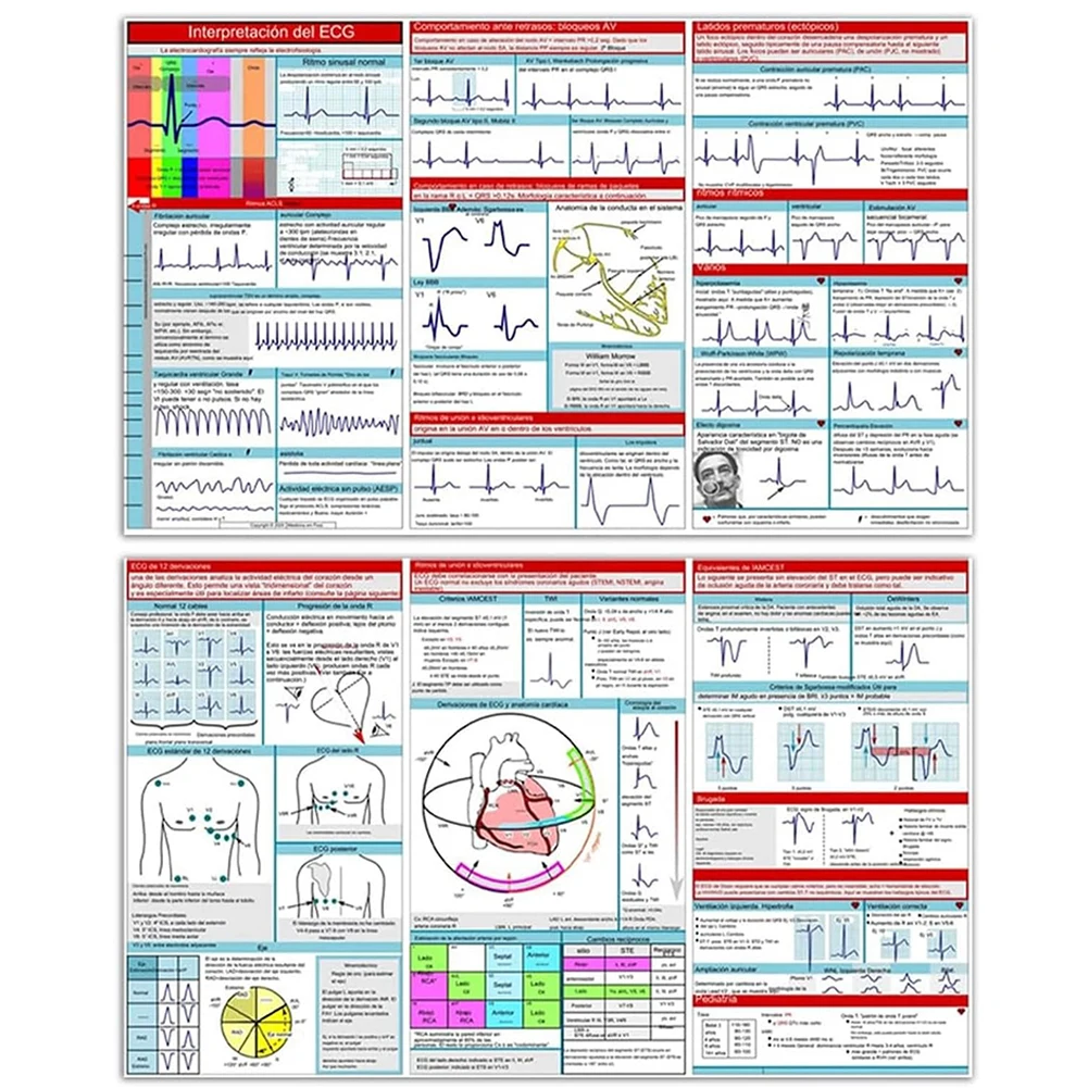 EKG Pocket Guide Compact Portable Reference Card ECG/EKG Rhythm Pocket Card for Rapid Interpretation
EKG Pocket Guide Compact Portable Reference Card ECG/EKG Rhythm Pocket Card for Rapid Interpretation