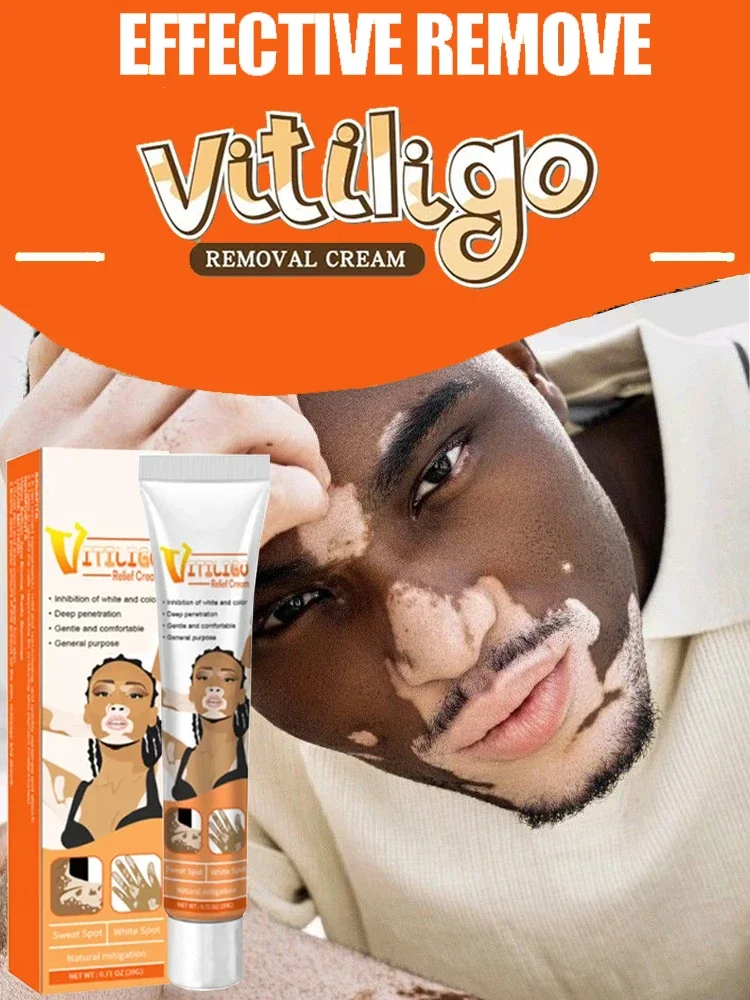 Effectively Remove Vitiligo Ointment Ringworm White Spot Removal Skin Vitiligo Eliminate Vitiligo Skin Care
Effectively Remove Vitiligo Ointment Ringworm White Spot Removal Skin Vitiligo Eliminate Vitiligo Skin Care
