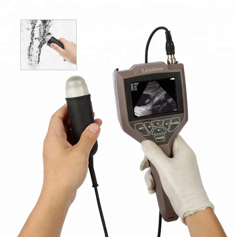 2026 Veterinary Equipment: PRUS-S3V Full Digital Palmtop Veterinary Use Ultrasound Equipment
2026 Veterinary Equipment: PRUS-S3V Full Digital Palmtop Veterinary Use Ultrasound Equipment