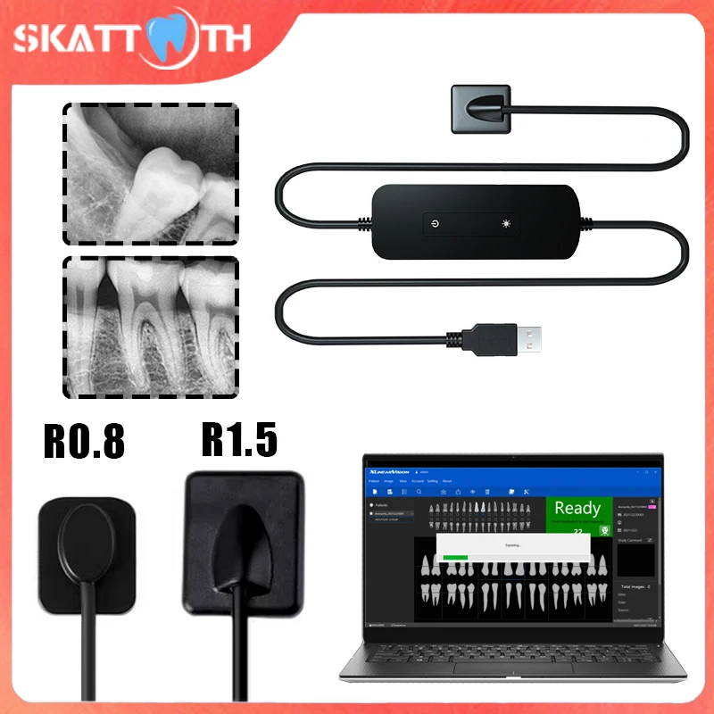 Стоматологический рентгеновский датчик Radiovisograph HD цифровая система внутриротовой визуализации портативный рентгеновский цифровой датчик стоматологические инструменты
Стоматологический рентгеновский датчик Radiovisograph HD цифровая система внутриротовой визуализации портативный рентгеновский цифровой датчик стоматологические инструменты