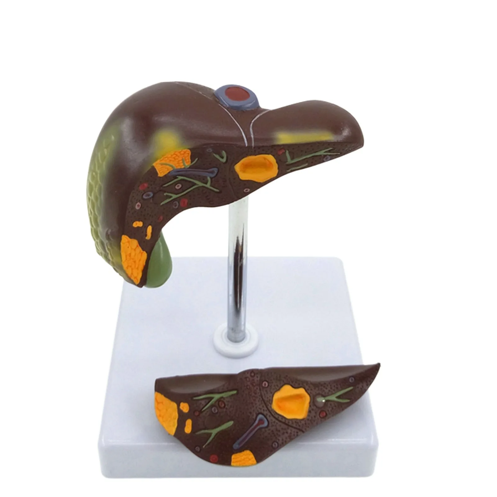 PVC Diseased Liver Anatomica Medical Model Stone Specimens Fatty Liver Teaching Aids
PVC Diseased Liver Anatomica Medical Model Stone Specimens Fatty Liver Teaching Aids
