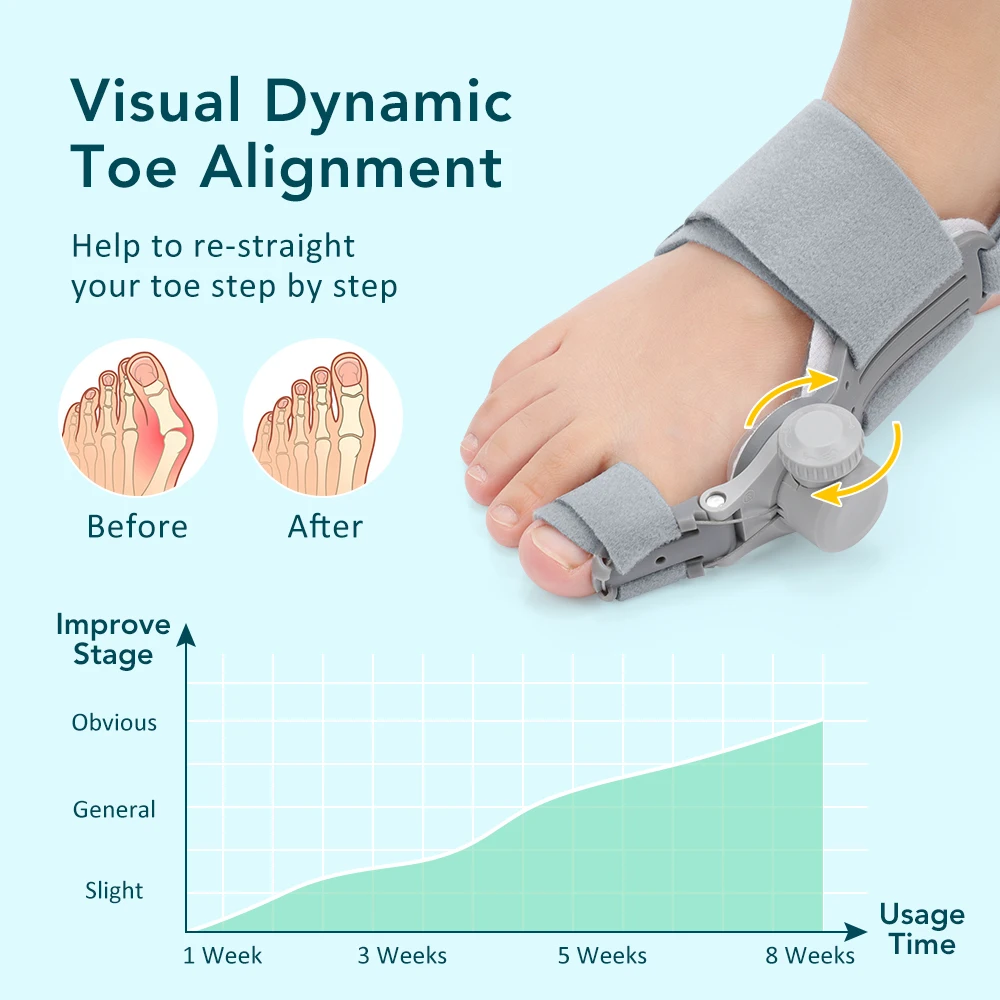 Bunion Corrector Hallux Valgus Braces Rotatable Toe Separator Straightener Adjustable Distinguish Between The Left/Right Feet
Bunion Corrector Hallux Valgus Braces Rotatable Toe Separator Straightener Adjustable Distinguish Between The Left/Right Feet