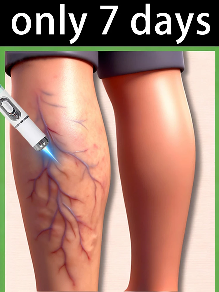 Лазерная ручка для обработки дождевых червей, ног, прорыв, модернизированная лазерная указка в течение 7 дней
Лазерная ручка для обработки дождевых червей, ног, прорыв, модернизированная лазерная указка в течение 7 дней