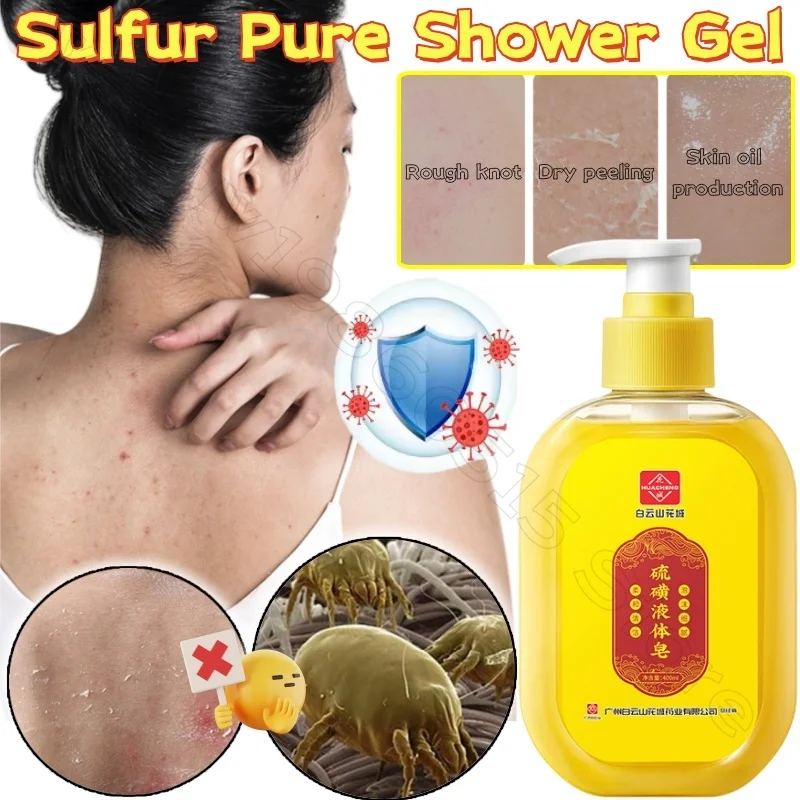 Herbal Formula Sulfur Shower Gel Deep Cleansing Skin Stains and Oils Effectively Remove Mites and Cleansing Skin Shower Gel
Herbal Formula Sulfur Shower Gel Deep Cleansing Skin Stains and Oils Effectively Remove Mites and Cleansing Skin Shower Gel