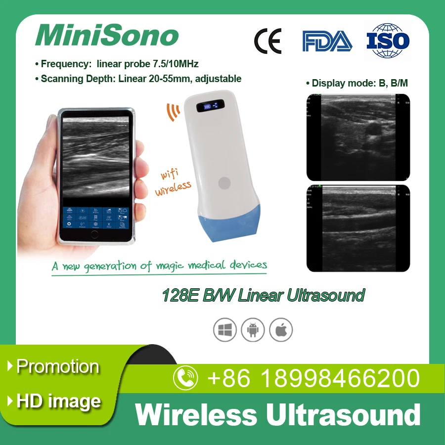 WiFi Linear ultrasound Machine, 128E Linear, 7/10MHZ, B/W Support, Connect with Smart Phone, Tablet, Computer
WiFi Linear ultrasound Machine, 128E Linear, 7/10MHZ, B/W Support, Connect with Smart Phone, Tablet, Computer