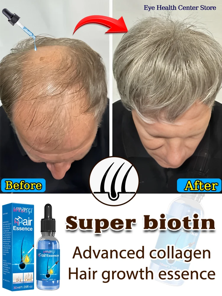 WPRBREGT. New product. Hair growth serum. The most suitable hair growth care oil. No. 1 repurchase
WPRBREGT. New product. Hair growth serum. The most suitable hair growth care oil. No. 1 repurchase