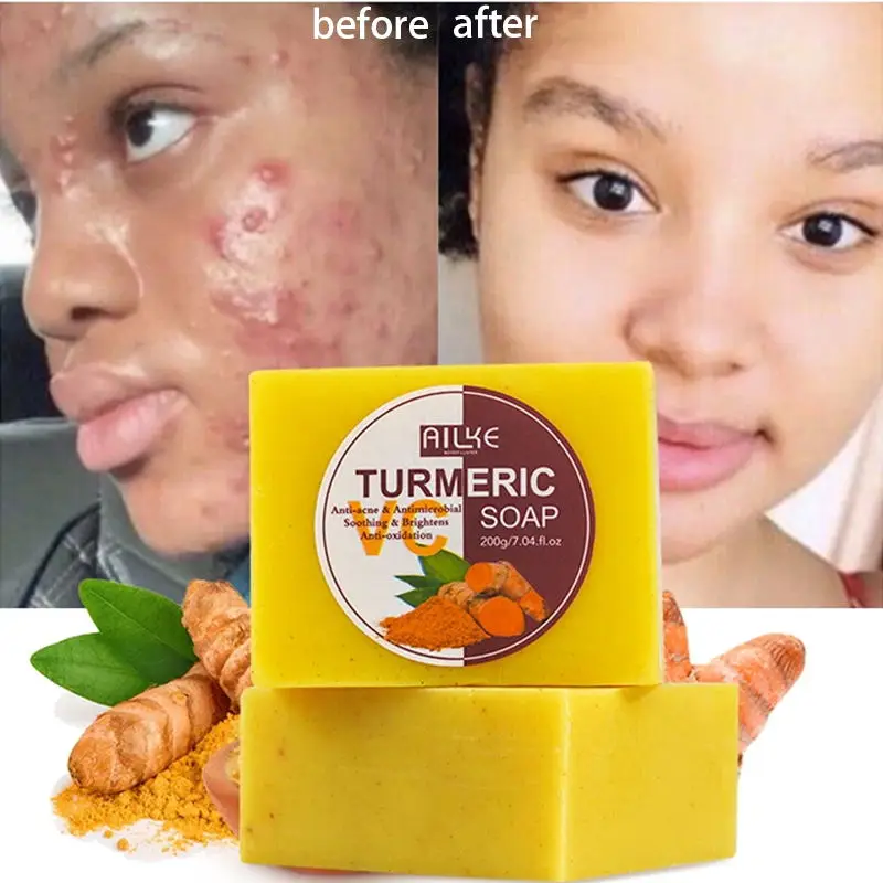 Мыло с куркумой и имбирем, 100 г
Мыло с куркумой и имбирем, 100 г