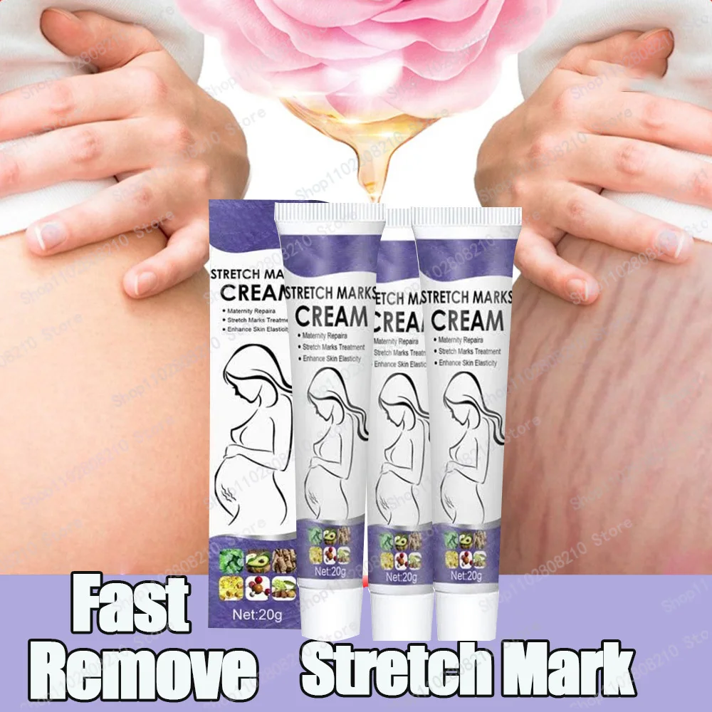 Stretch Mark Removal Permanently Removes Stretch Marks Rejuvenates Skin Stretch Mark Removal
Stretch Mark Removal Permanently Removes Stretch Marks Rejuvenates Skin Stretch Mark Removal