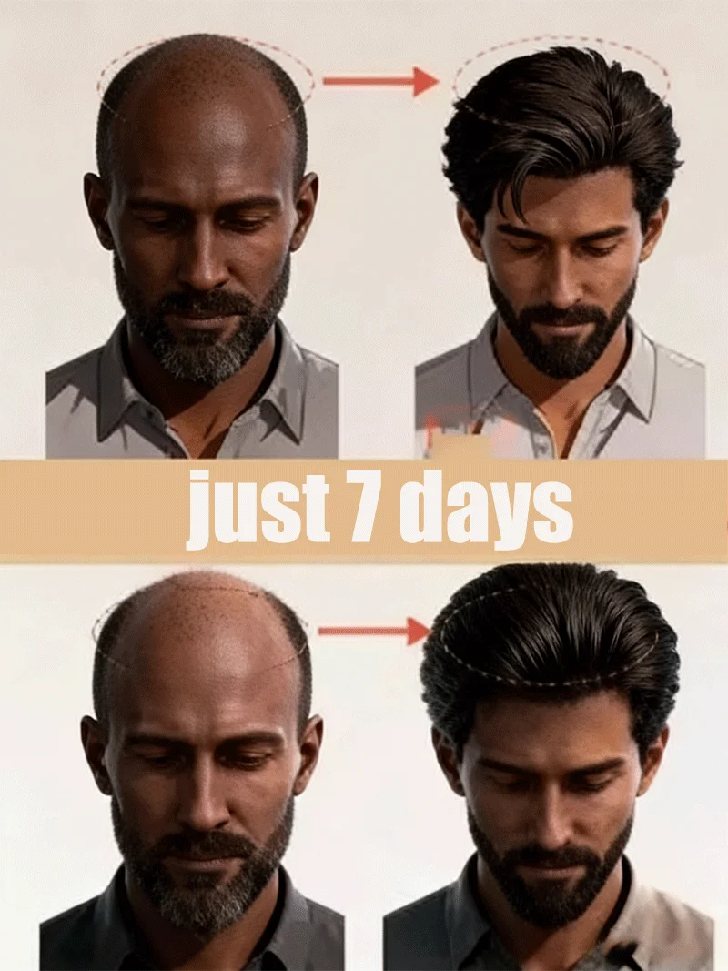 Prevent Hair Loss, Repair Scalp, Restore Hair Health, Boost Thickness
Prevent Hair Loss, Repair Scalp, Restore Hair Health, Boost Thickness