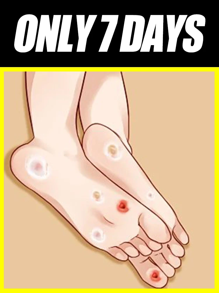 Устраните эти неровные, черные узлы, используйте средство для лечения бородавок, чтобы сделать ваши ноги более комфортными и уменьшить дискомфорт.
Устраните эти неровные, черные узлы, используйте средство для лечения бородавок, чтобы сделать ваши ноги более комфортными и уменьшить дискомфорт.