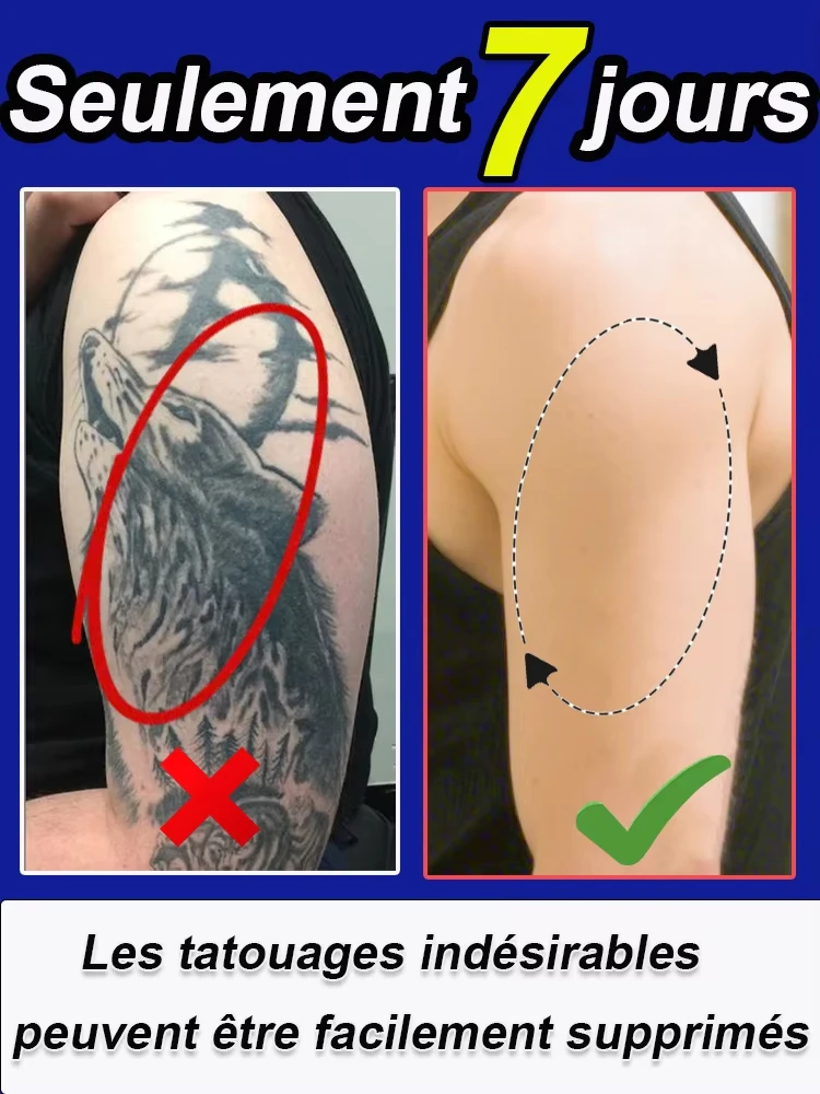 Tattoo Removal Cream, Suitable for Large and Small Tattoos, Effective in Removing Permanent Tattoos
Tattoo Removal Cream, Suitable for Large and Small Tattoos, Effective in Removing Permanent Tattoos