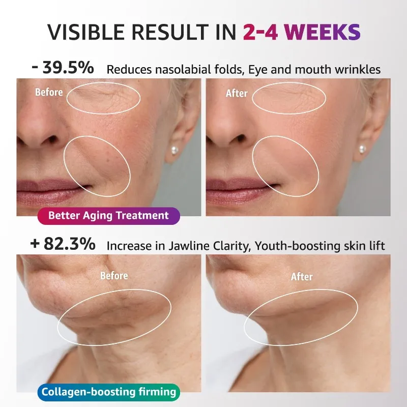 Массажер для шеи B02C для уменьшения морщин на шее и носогубных складок - микротоковый массажер EMS с вибрацией
Массажер для шеи B02C для уменьшения морщин на шее и носогубных складок - микротоковый массажер EMS с вибрацией