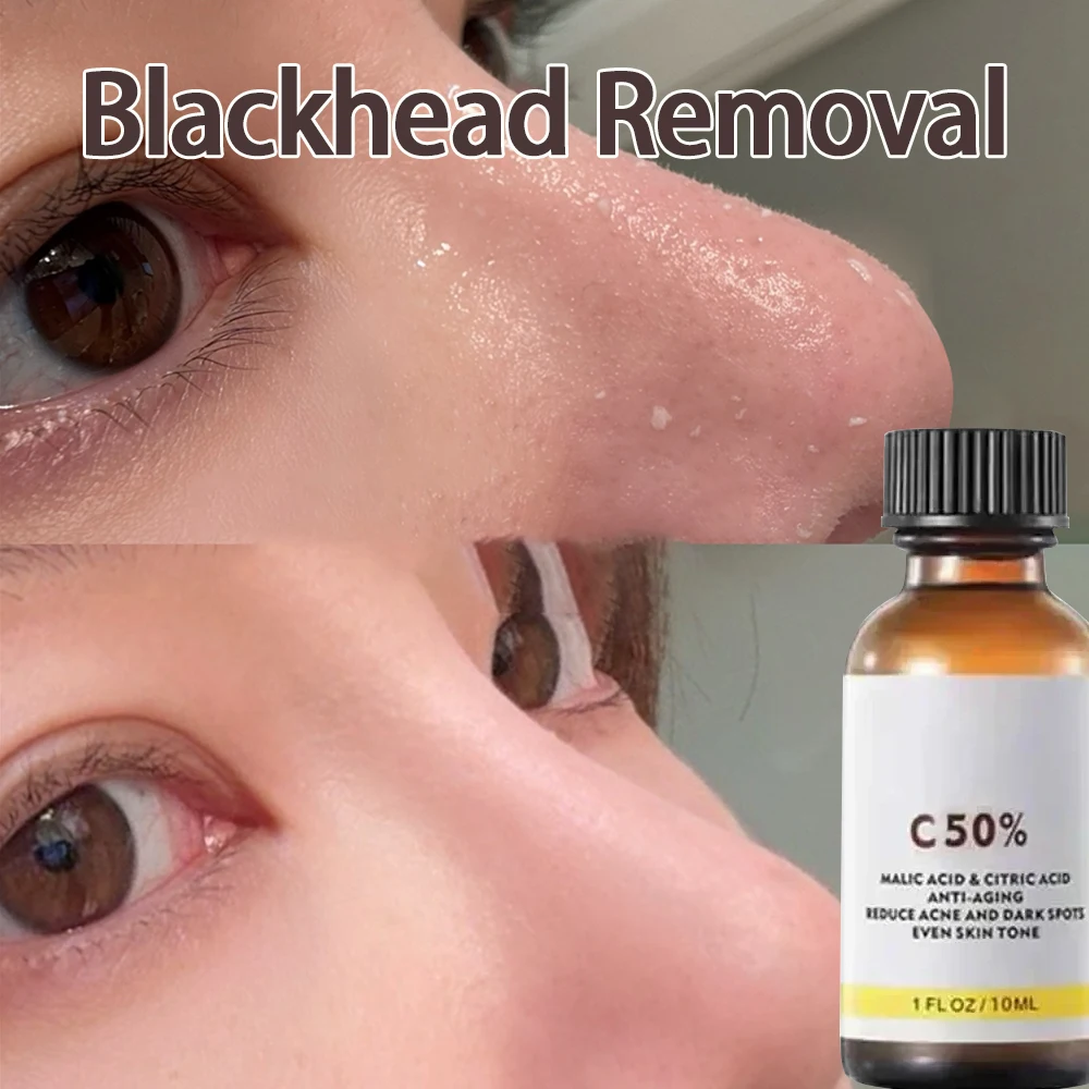 Peeling Oil Bleaching Dark Skin Spots Remove Dead Skin Lighten Melanin Scrub Exfoliating, Brighten Moisturize
Peeling Oil Bleaching Dark Skin Spots Remove Dead Skin Lighten Melanin Scrub Exfoliating, Brighten Moisturize