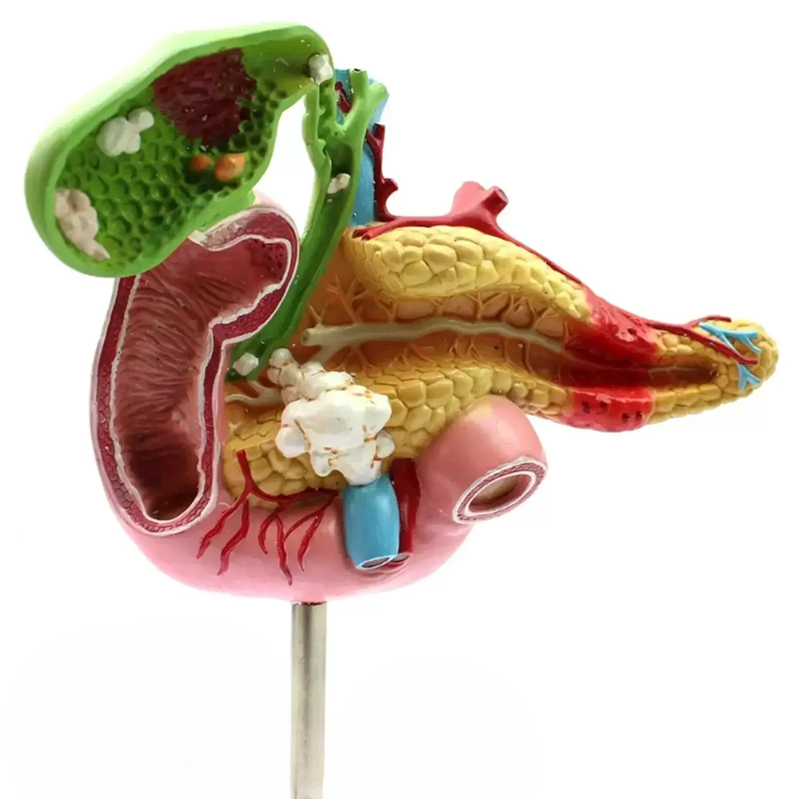 PVC Human Cholecystitis Polyps Gallstones Duodenal Ulcer Model Medical Teaching Models
PVC Human Cholecystitis Polyps Gallstones Duodenal Ulcer Model Medical Teaching Models