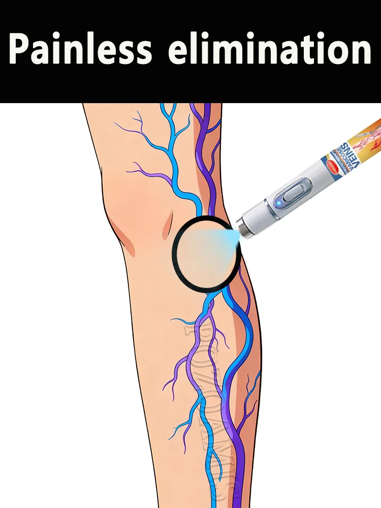 Bʟᴜᴇ ʟɪɢʜᴛ ᴘᴇɴ ᴘʀᴏᴍᴏᴛᴇs ʙʟᴏᴏᴅ ᴄɪʀᴄᴜʟᴀᴛɪᴏɴ ᴀɴᴅ ʀᴇᴅᴜᴄᴇs sᴇᴅᴇɴᴛᴀʀʏ ʟɪғᴇsᴛʏ
Bʟᴜᴇ ʟɪɢʜᴛ ᴘᴇɴ ᴘʀᴏᴍᴏᴛᴇs ʙʟᴏᴏᴅ ᴄɪʀᴄᴜʟᴀᴛɪᴏɴ ᴀɴᴅ ʀᴇᴅᴜᴄᴇs sᴇᴅᴇɴᴛᴀʀʏ ʟɪғᴇsᴛʏ