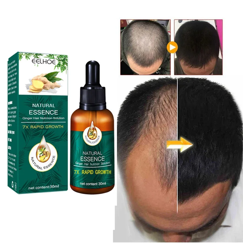 Effective Fast Ginger Hair Growth Products Essential Hair and Scalp Treatment Oil Serum Anti-Hair Loss Repair Hair Scalp Damaged
Effective Fast Ginger Hair Growth Products Essential Hair and Scalp Treatment Oil Serum Anti-Hair Loss Repair Hair Scalp Damaged