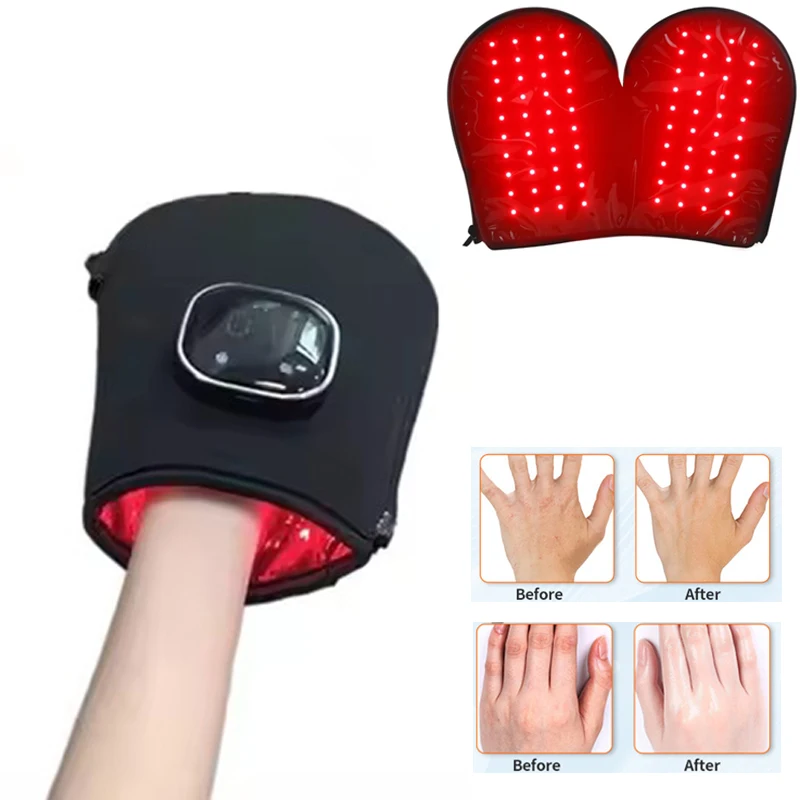 NEW Red Light Therapy Device for Hands Led Near Infrared Light Skin Care USB Charging,Infrared Light Therapy Gloves Finger Wrist
NEW Red Light Therapy Device for Hands Led Near Infrared Light Skin Care USB Charging,Infrared Light Therapy Gloves Finger Wrist