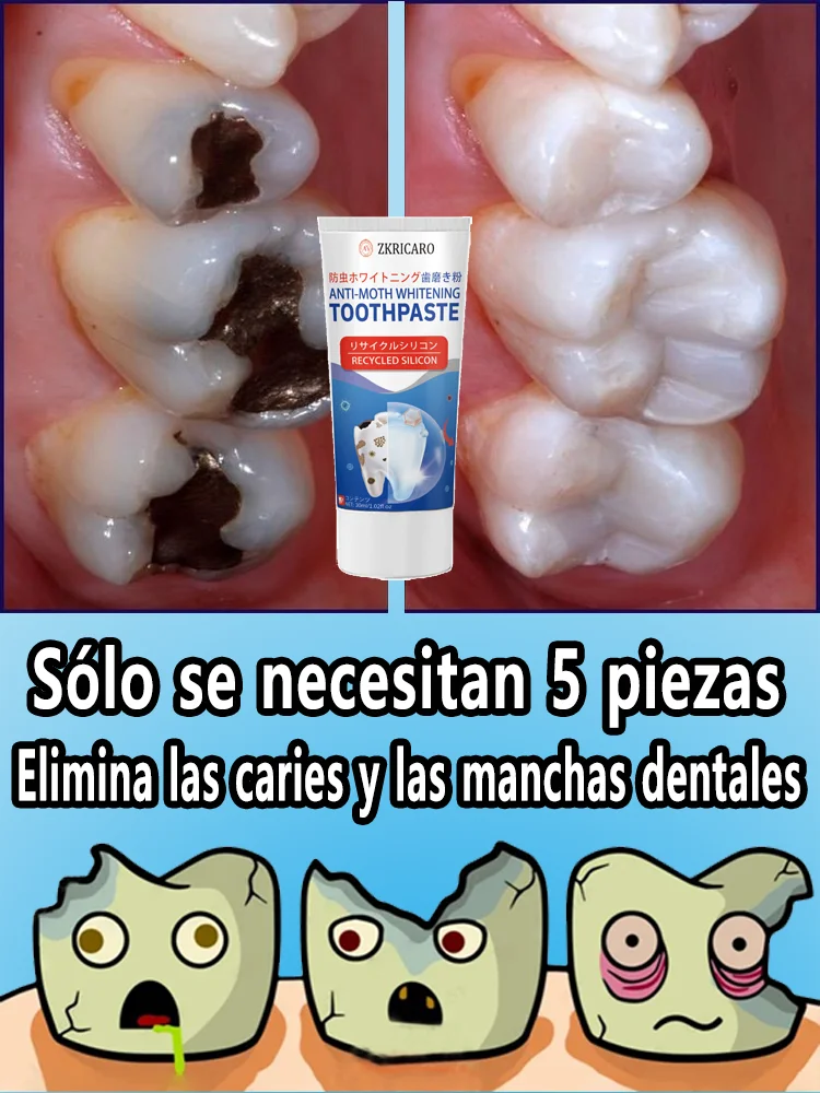 Отбеливающая зубная паста для защиты полости рта 2 в 1, профессиональная прочность — удаляет пятна от кофе, чая, дыма, безопасную эмаль, фторид
Отбеливающая зубная паста для защиты полости рта 2 в 1, профессиональная прочность — удаляет пятна от кофе, чая, дыма, безопасную эмаль, фторид