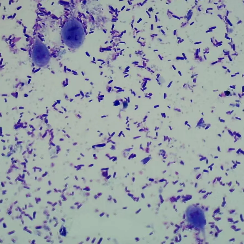1 Piece Giardia Lamblia Trophozoites Parasite Prepared Slides
1 Piece Giardia Lamblia Trophozoites Parasite Prepared Slides