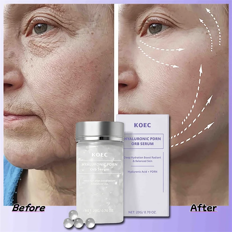 Hyaluronic Acid PDRN ORB Serum Bursting Bubble Pearl Essence Deep Hydration Brighten Boost Radiant Balanced Skin Care Beauty 20g
Hyaluronic Acid PDRN ORB Serum Bursting Bubble Pearl Essence Deep Hydration Brighten Boost Radiant Balanced Skin Care Beauty 20g