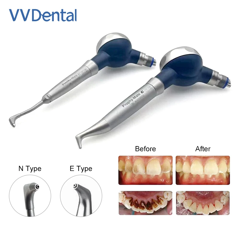 VVDental Dental Air Polisher Prophy-Mate Air Polisher 360 Degree Rotation Handpiece Teeth Whitening Spray Sandblasting Equipment
VVDental Dental Air Polisher Prophy-Mate Air Polisher 360 Degree Rotation Handpiece Teeth Whitening Spray Sandblasting Equipment