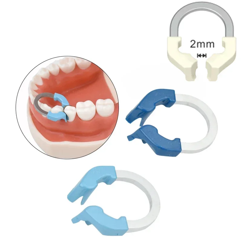 Dentist Material Dental Matrix Bands Niti Clamp Sectional Contoured Matrix System Metal Matrices Nickel Titanium Clamping Ring
Dentist Material Dental Matrix Bands Niti Clamp Sectional Contoured Matrix System Metal Matrices Nickel Titanium Clamping Ring