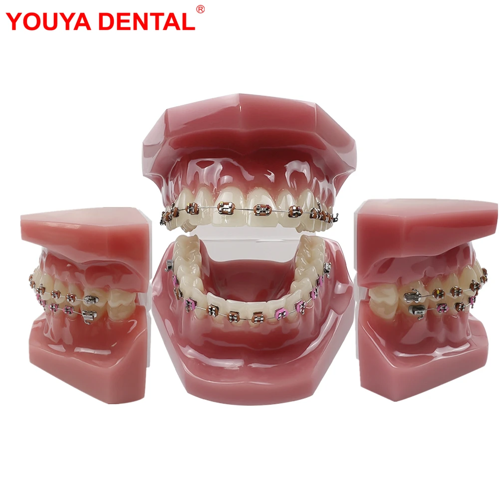 Dental Orthodontic Model With All Metal Bracket Normal Ortho Teeth Model For Teaching Education Dentist-Patient Communication
Dental Orthodontic Model With All Metal Bracket Normal Ortho Teeth Model For Teaching Education Dentist-Patient Communication
