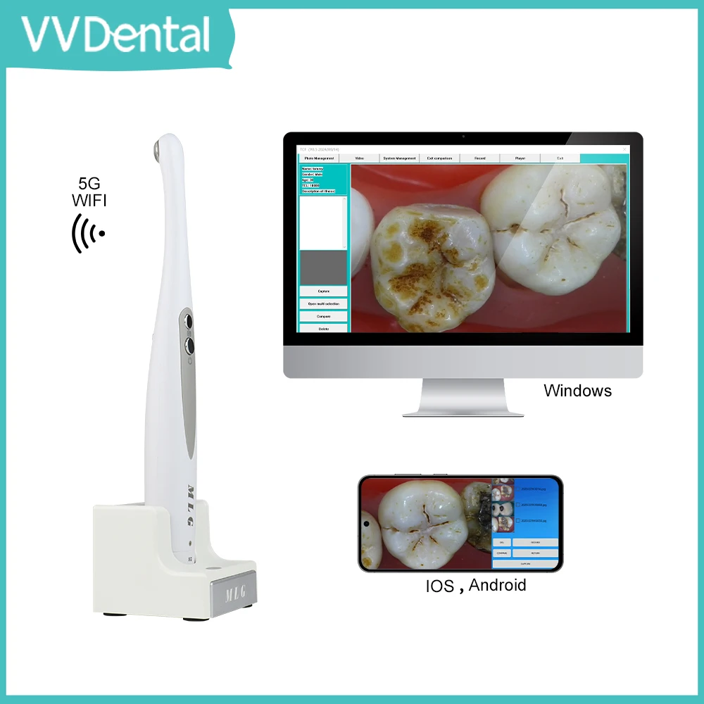 VVDental Dental Oral Viewer Wireless 5G WiFi to USB Intraoral Camera Compatible with Windows, Android, Apple Systems
VVDental Dental Oral Viewer Wireless 5G WiFi to USB Intraoral Camera Compatible with Windows, Android, Apple Systems