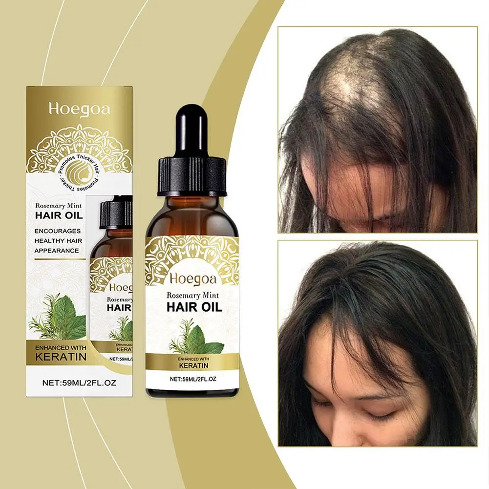 Rosemary Mint Essential Oil Hair Strengthening Nourishes Smooth Hair Oil Shiny Scalp Moisturizing Care G3V2
Rosemary Mint Essential Oil Hair Strengthening Nourishes Smooth Hair Oil Shiny Scalp Moisturizing Care G3V2