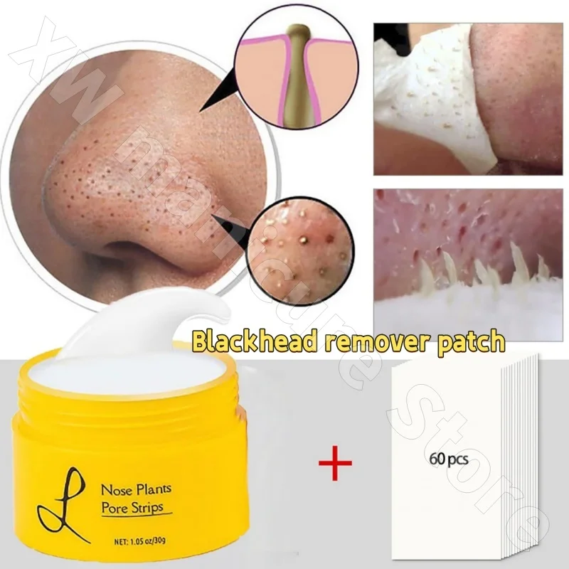 Luelle Pore Strips Blackhead Remover 30g Removes Blackheads Shrinks Pores Nourishes and Moisturizes Delicate Skin
Luelle Pore Strips Blackhead Remover 30g Removes Blackheads Shrinks Pores Nourishes and Moisturizes Delicate Skin