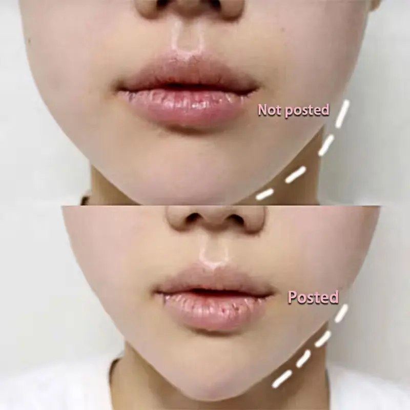 22 Bottles Face Lift Tape Invisible for Facial Stickers Lifting Thin Chin V Pat
22 Bottles Face Lift Tape Invisible for Facial Stickers Lifting Thin Chin V Pat