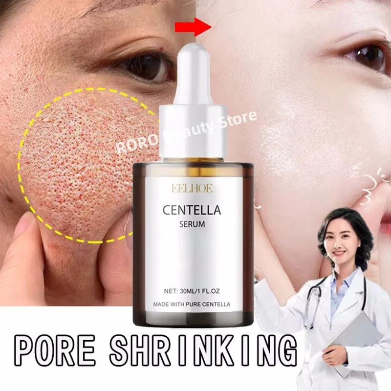 Remove Large Pores Serum Lactic Acid Facial Pore Shrinking Repairing Products Pore Minimizing Firming Smooth Korean Skin Care
Remove Large Pores Serum Lactic Acid Facial Pore Shrinking Repairing Products Pore Minimizing Firming Smooth Korean Skin Care