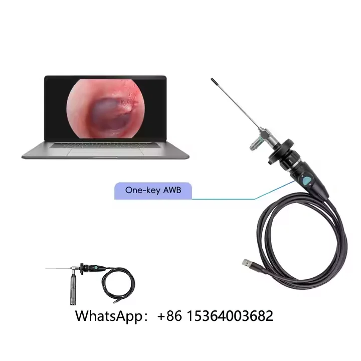 SNUKE 1080P Endoscope Camera Portable Endoscope System for ENT Suregery and Pet Endoscope
SNUKE 1080P Endoscope Camera Portable Endoscope System for ENT Suregery and Pet Endoscope
