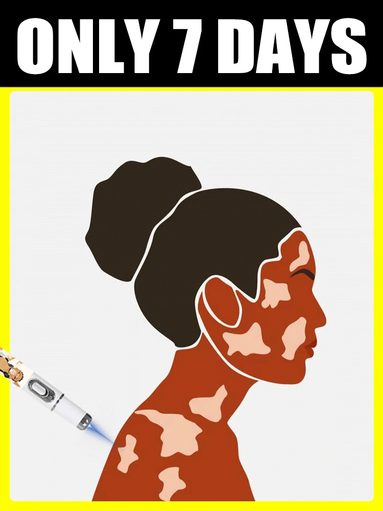 Mini laser pen can solve Vitiligo, your right choice.
Mini laser pen can solve Vitiligo, your right choice.