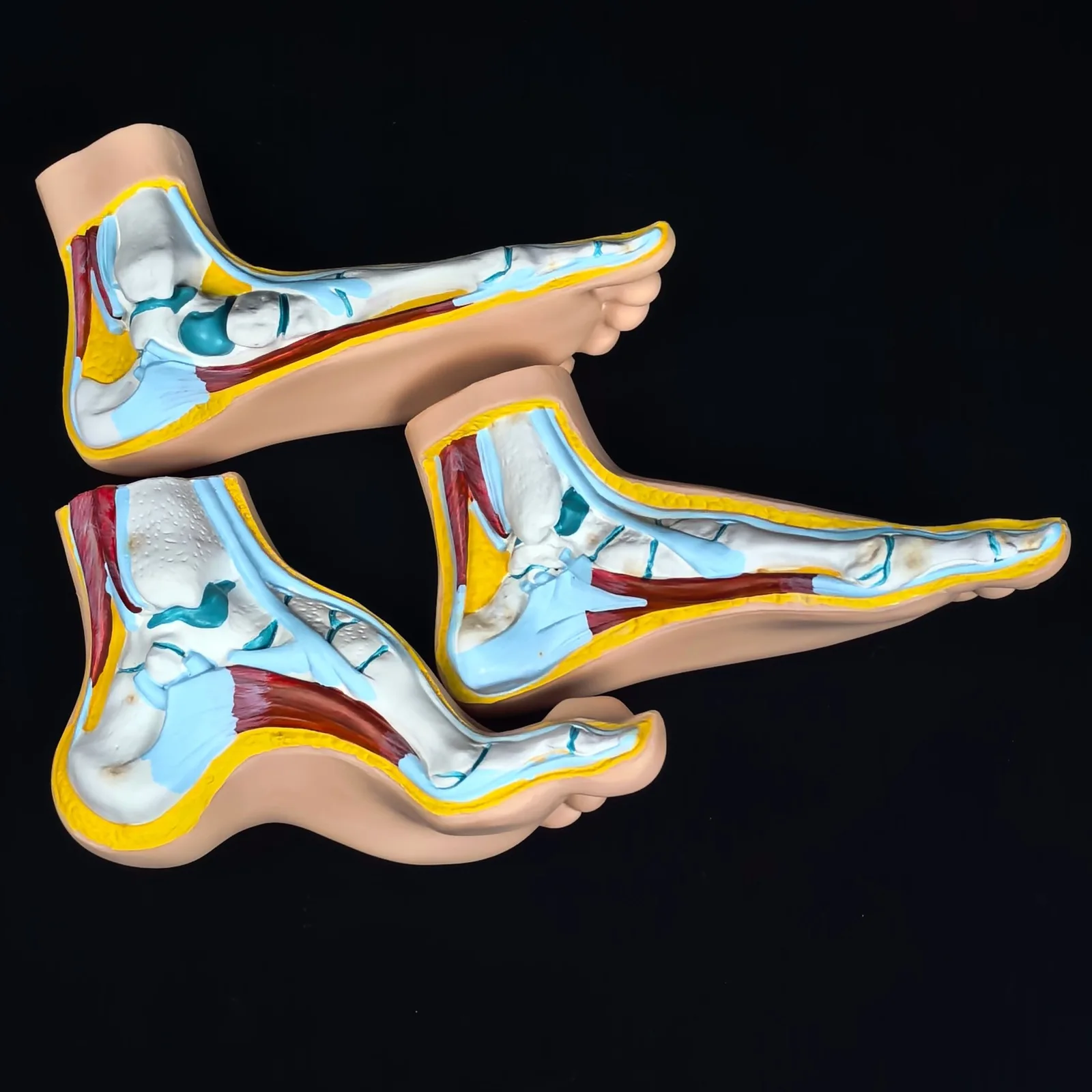 PVC Normal Human Foot Platypodia Bow Foot Anatomy Model Muscle Vascular Teaching
PVC Normal Human Foot Platypodia Bow Foot Anatomy Model Muscle Vascular Teaching