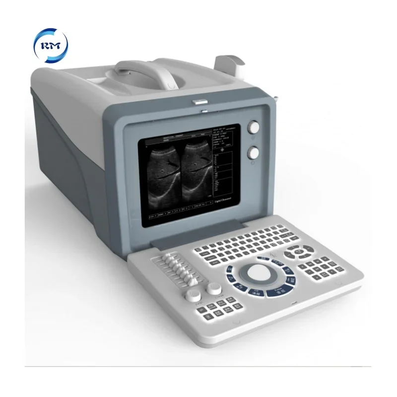Portable Ultrasound Machine Full Digital Portable B/W Ultrasound Scanner for human use
Portable Ultrasound Machine Full Digital Portable B/W Ultrasound Scanner for human use
