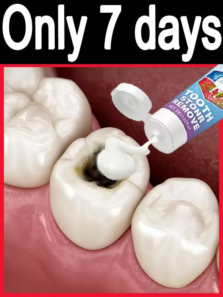 Sᴄɪᴇɴᴛɪғɪᴄ Cᴀᴠɪᴛʏ Rᴇᴘᴀɪʀ, Tʜᴏʀᴏᴜɢʜ Pʟᴀᴏ̨ᴜᴇ Cʟᴇᴀɴɪɴɢ, Vɪsɪʙʟᴇ Tᴇᴇᴛʜ Wʜɪᴛᴇɴɪ Help your smile gain the confidence to stand out
Sᴄɪᴇɴᴛɪғɪᴄ Cᴀᴠɪᴛʏ Rᴇᴘᴀɪʀ, Tʜᴏʀᴏᴜɢʜ Pʟᴀᴏ̨ᴜᴇ Cʟᴇᴀɴɪɴɢ, Vɪsɪʙʟᴇ Tᴇᴇᴛʜ Wʜɪᴛᴇɴɪ Help your smile gain the confidence to stand out