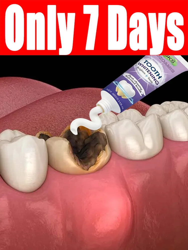 Pʀᴏғᴇssɪᴏɴᴀʟ Oʀᴀʟ Cᴀʀᴇ: Mᴇɴᴅs Cᴀᴠɪᴛɪᴇs, Sᴡᴇᴇᴘs Pʟᴀᴏ̨ᴜᴇ, Bʀɪɢʜᴛᴇɴs Tᴇᴇᴛʜ
Pʀᴏғᴇssɪᴏɴᴀʟ Oʀᴀʟ Cᴀʀᴇ: Mᴇɴᴅs Cᴀᴠɪᴛɪᴇs, Sᴡᴇᴇᴘs Pʟᴀᴏ̨ᴜᴇ, Bʀɪɢʜᴛᴇɴs Tᴇᴇᴛʜ