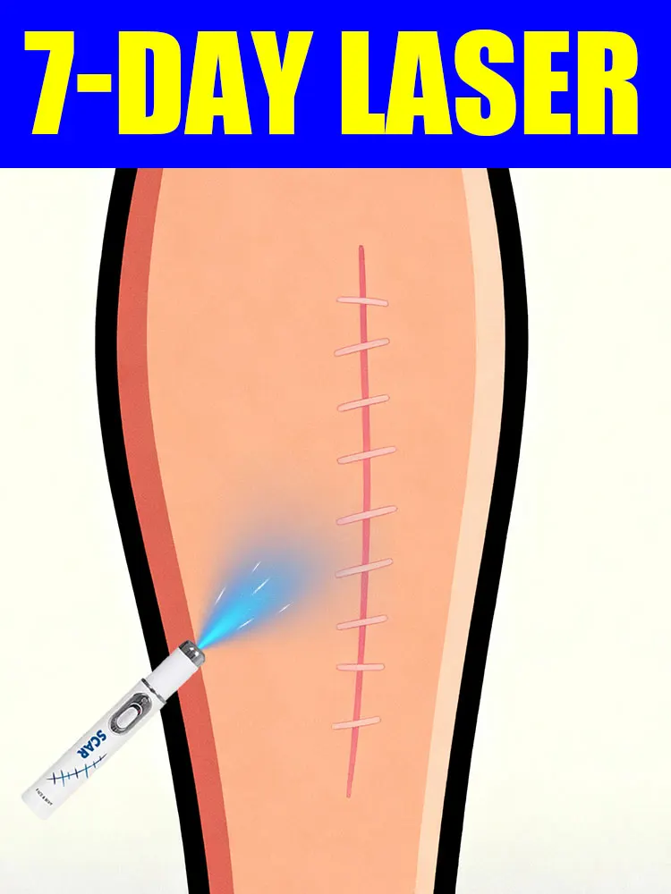 2 generation laser pens to solve your scar problems and keep your skin healthy
2 generation laser pens to solve your scar problems and keep your skin healthy