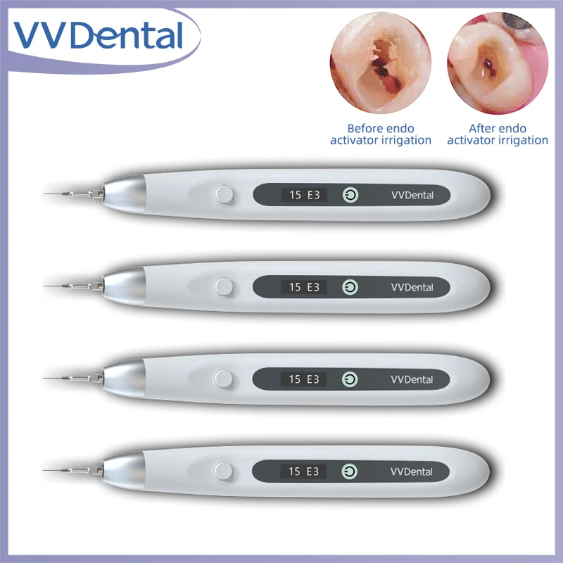 Стоматологический звуковой ирригатор, ультразвуковой эндоактиватор со светодиодной подсветкой для очистки корневых каналов, удаления калорийных пятен
Стоматологический звуковой ирригатор, ультразвуковой эндоактиватор со светодиодной подсветкой для очистки корневых каналов, удаления калорийных пятен