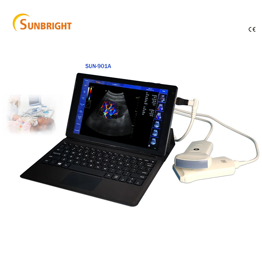 PC-based remote consultation high performance color doppler ultrasound convex scanner Real-time obstetrics echo
PC-based remote consultation high performance color doppler ultrasound convex scanner Real-time obstetrics echo